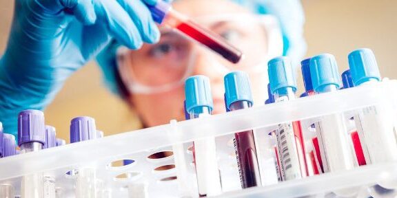 xét nghiệm máu